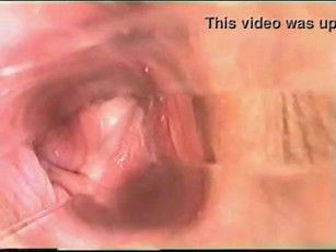 Camera up vagina