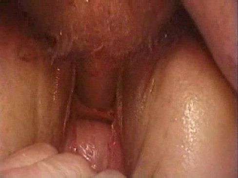 X reccomend urethra creampie